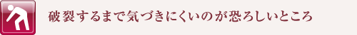 破裂するまで気づきにくいのが恐ろしいところ